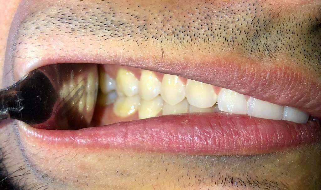 Remote Orthodontic Consultations Dublin Orthodontics